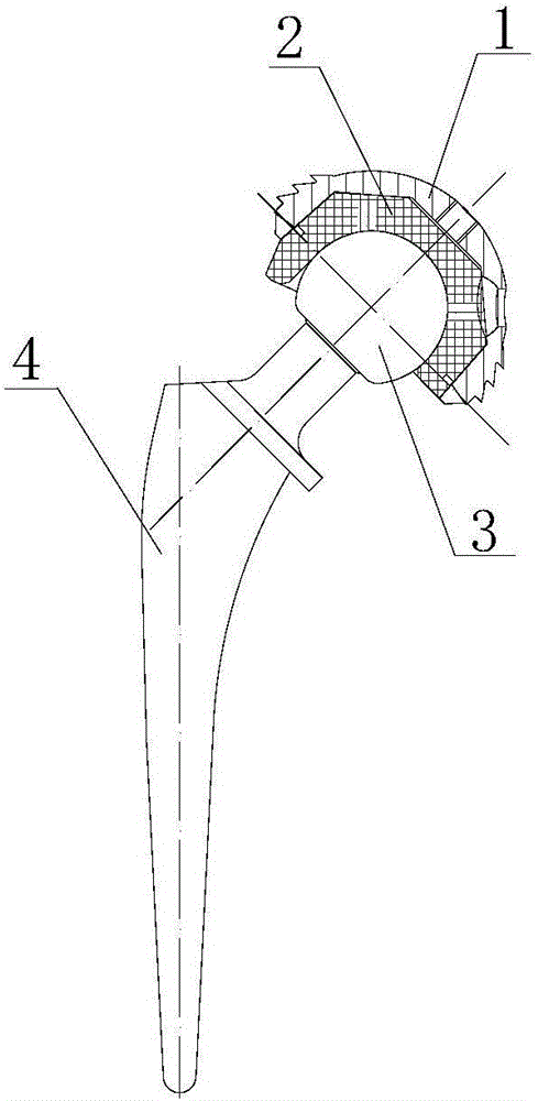 Non-metal ball hip joint prosthesis