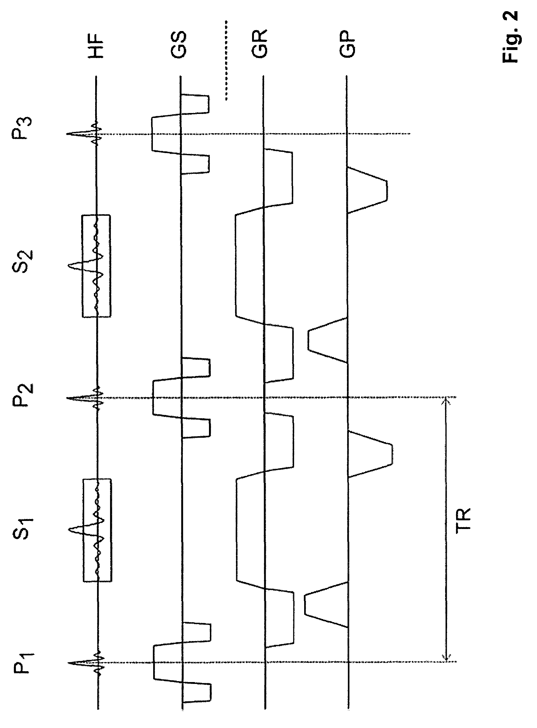 Eddy current compensation with N-average SSFP imaging