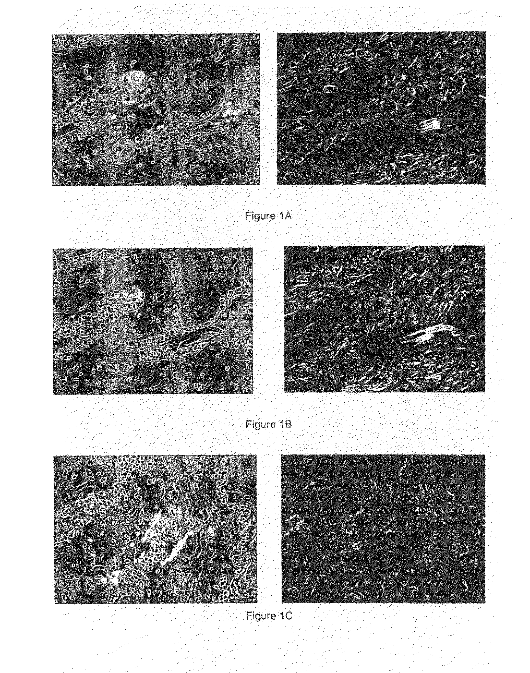 Modulators of the transporter ABCD3 for treating acne or hyperseborrhea