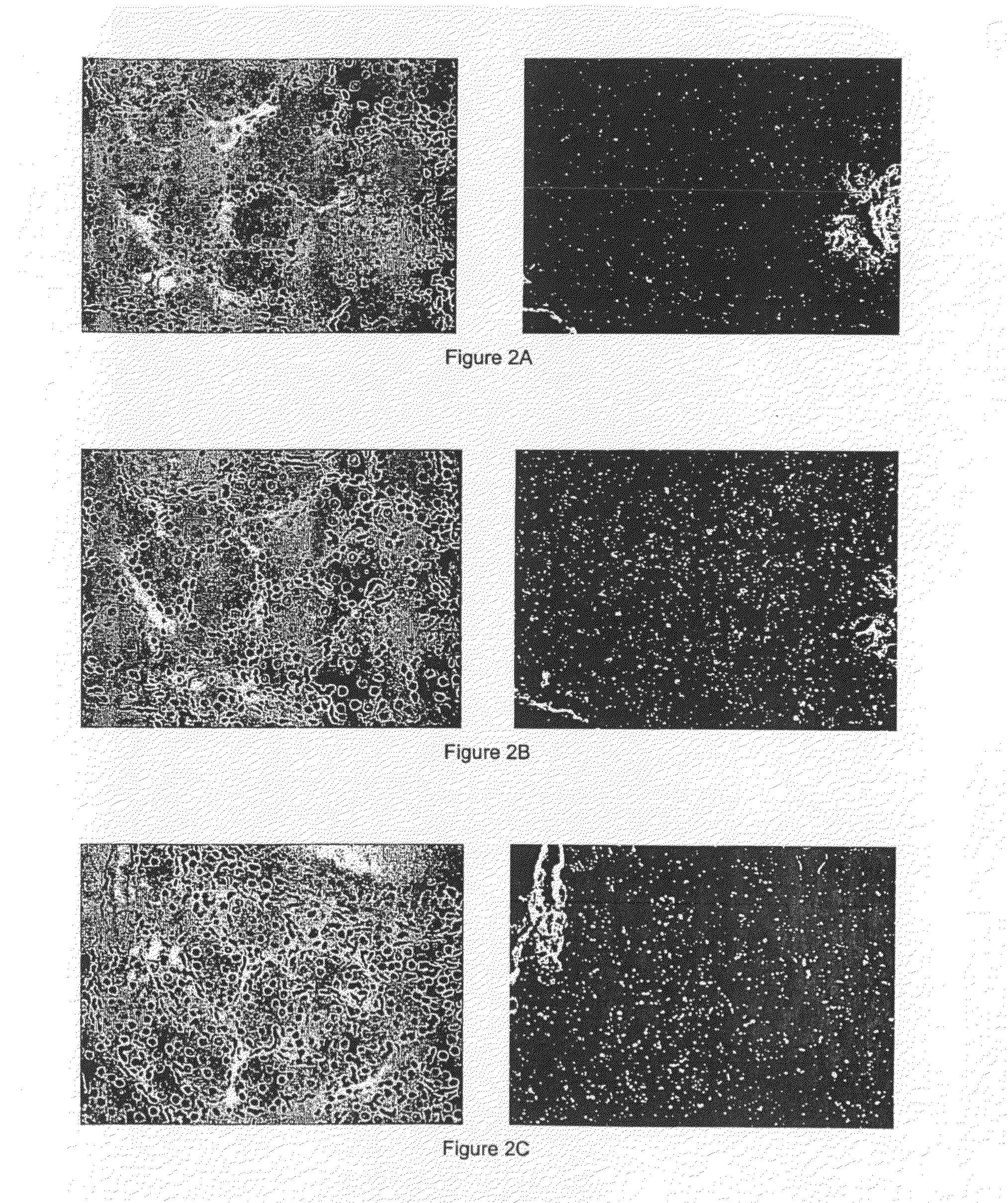 Modulators of the transporter ABCD3 for treating acne or hyperseborrhea