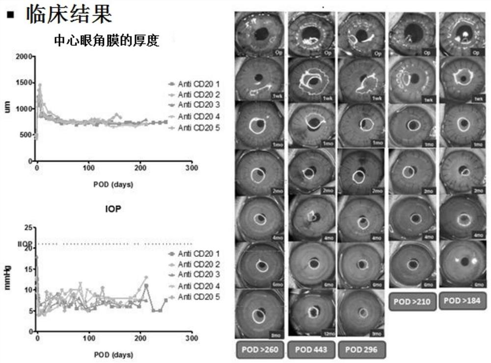 Combined immunosuppressive method of anti-CD20 monoclonal antibody and tacrolimus in corneal xenotransplantation