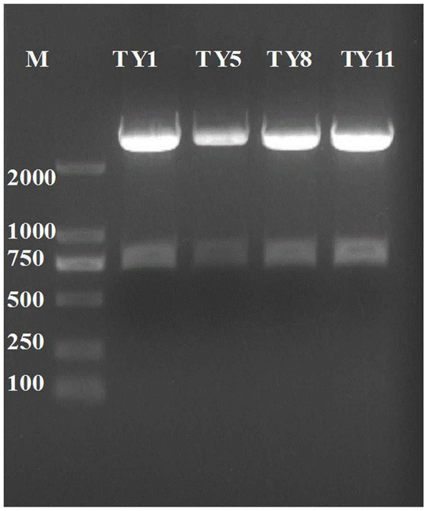 Neutralizing monoclonal antibody resisting to tetanus toxin and application thereof