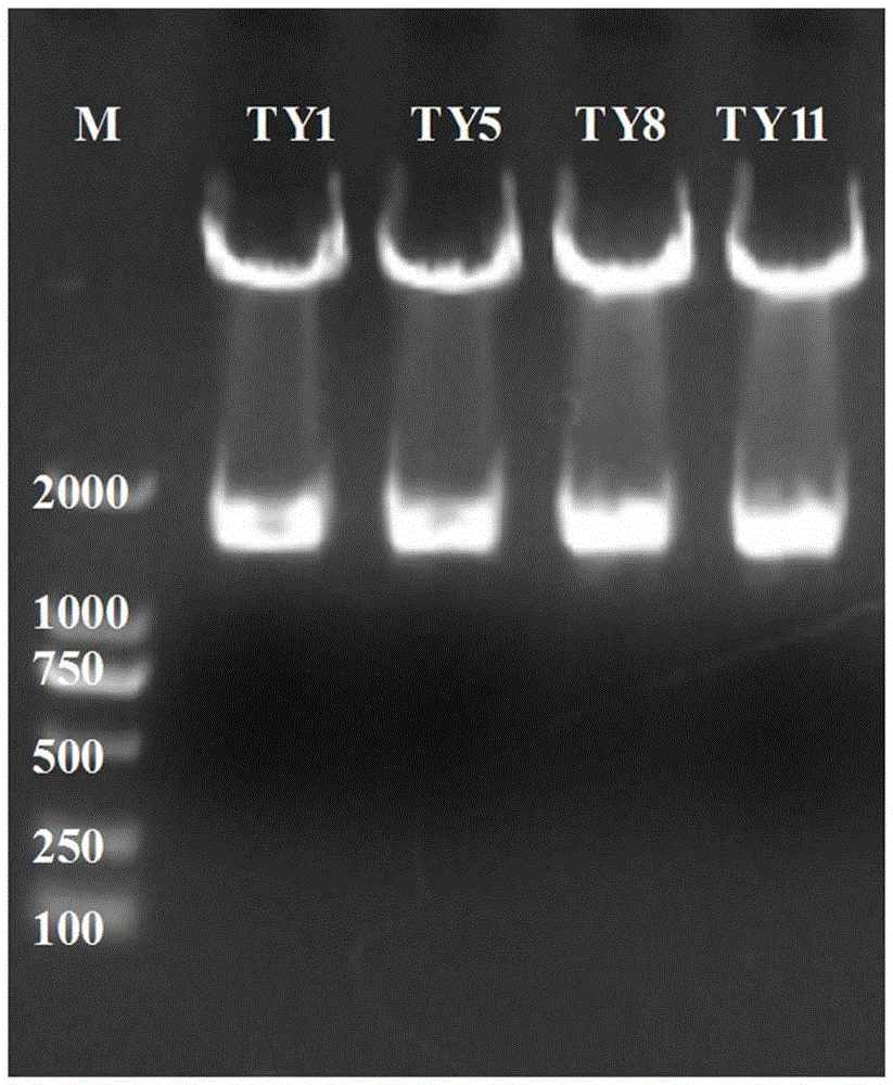 Neutralizing monoclonal antibody resisting to tetanus toxin and application thereof