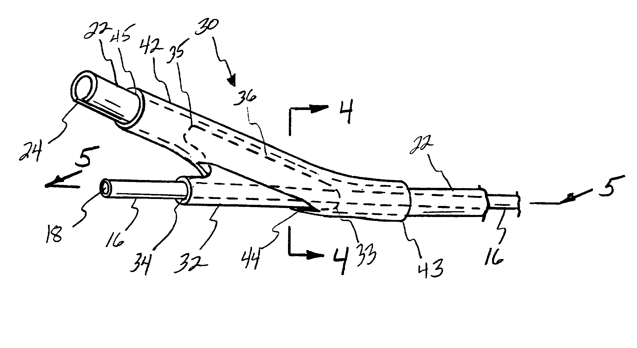 Endovascular catheter resheathing apparatus and related methods