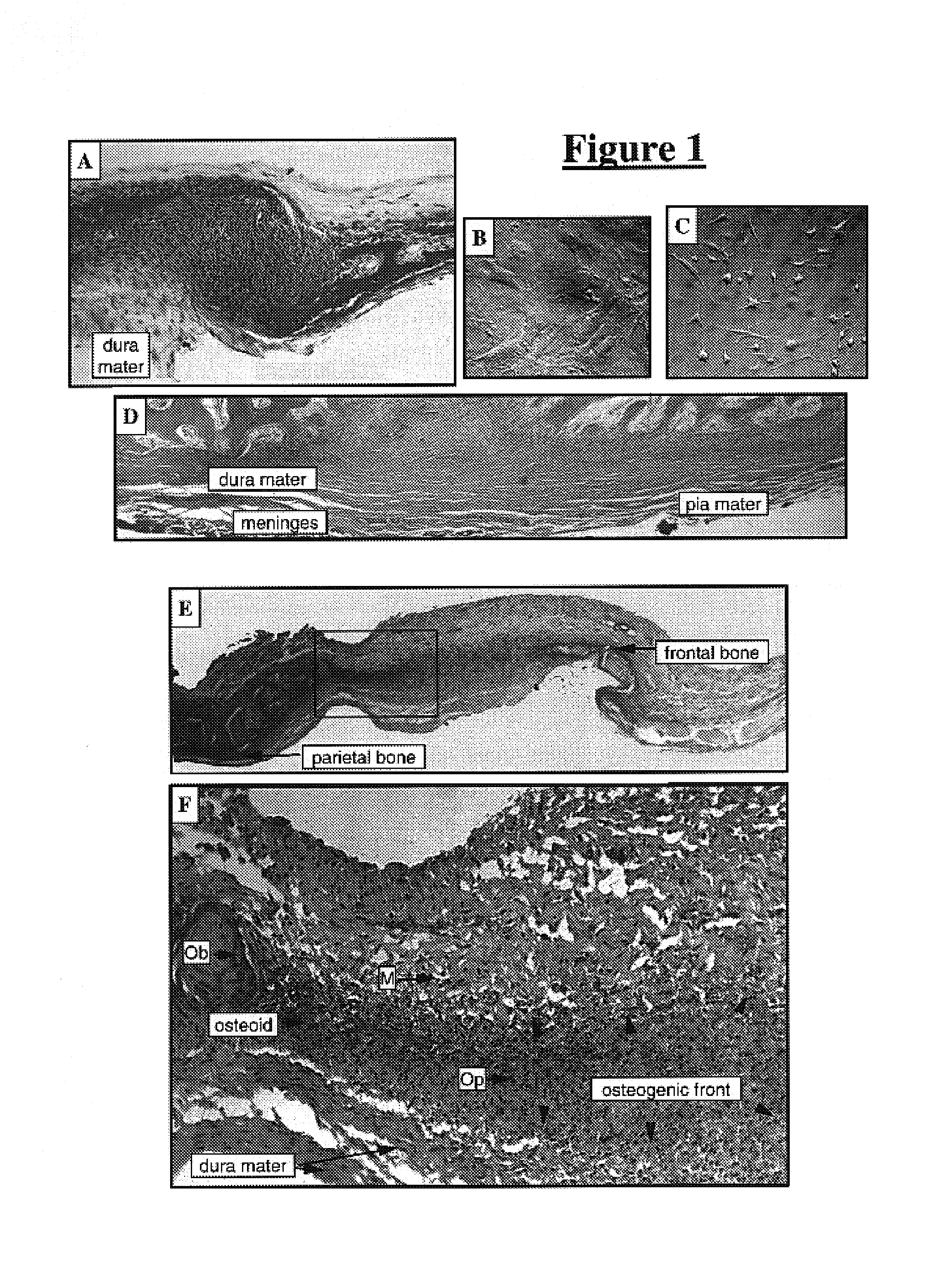 Meningeal-derived stem cells