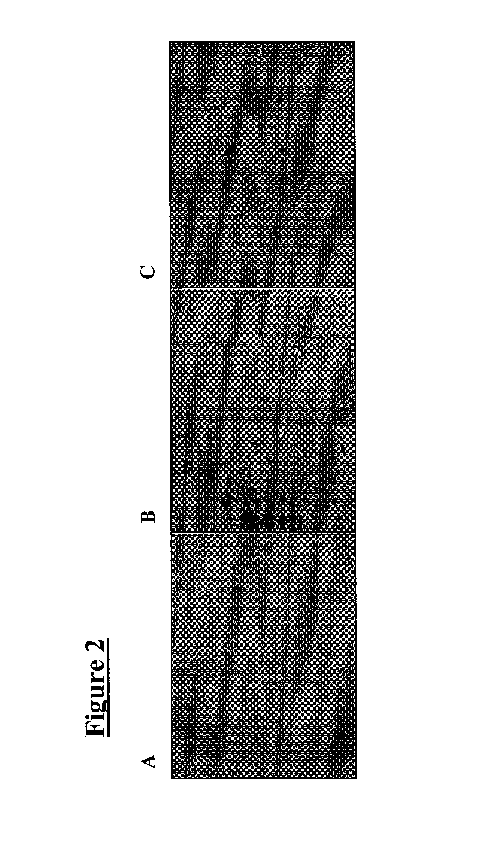 Meningeal-derived stem cells