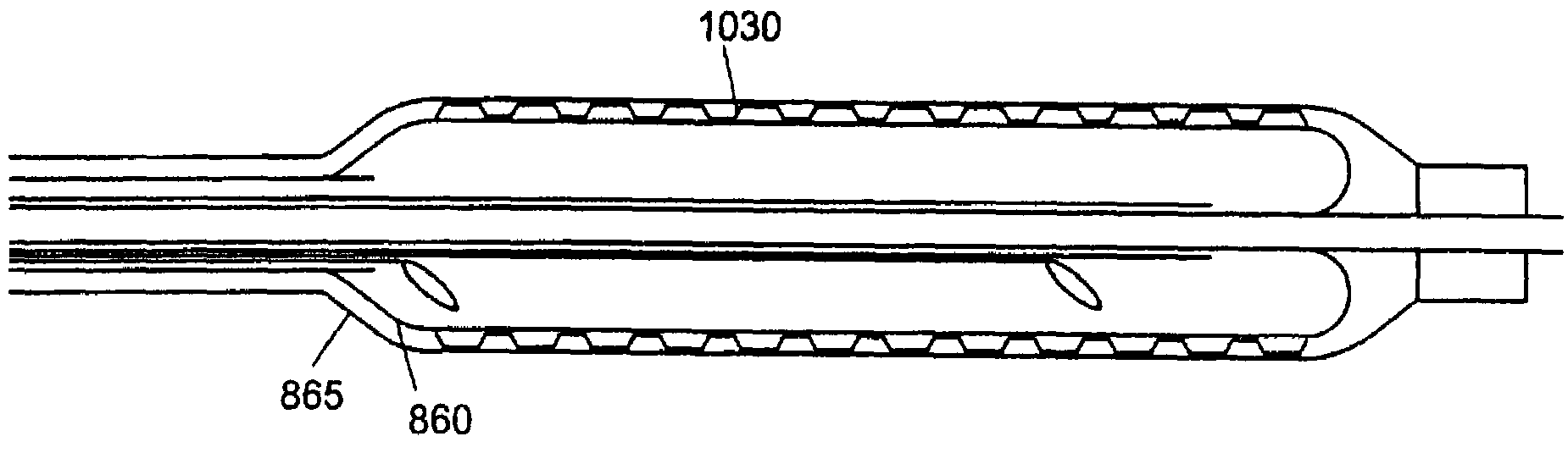 Endovascular cryotreatment catheter