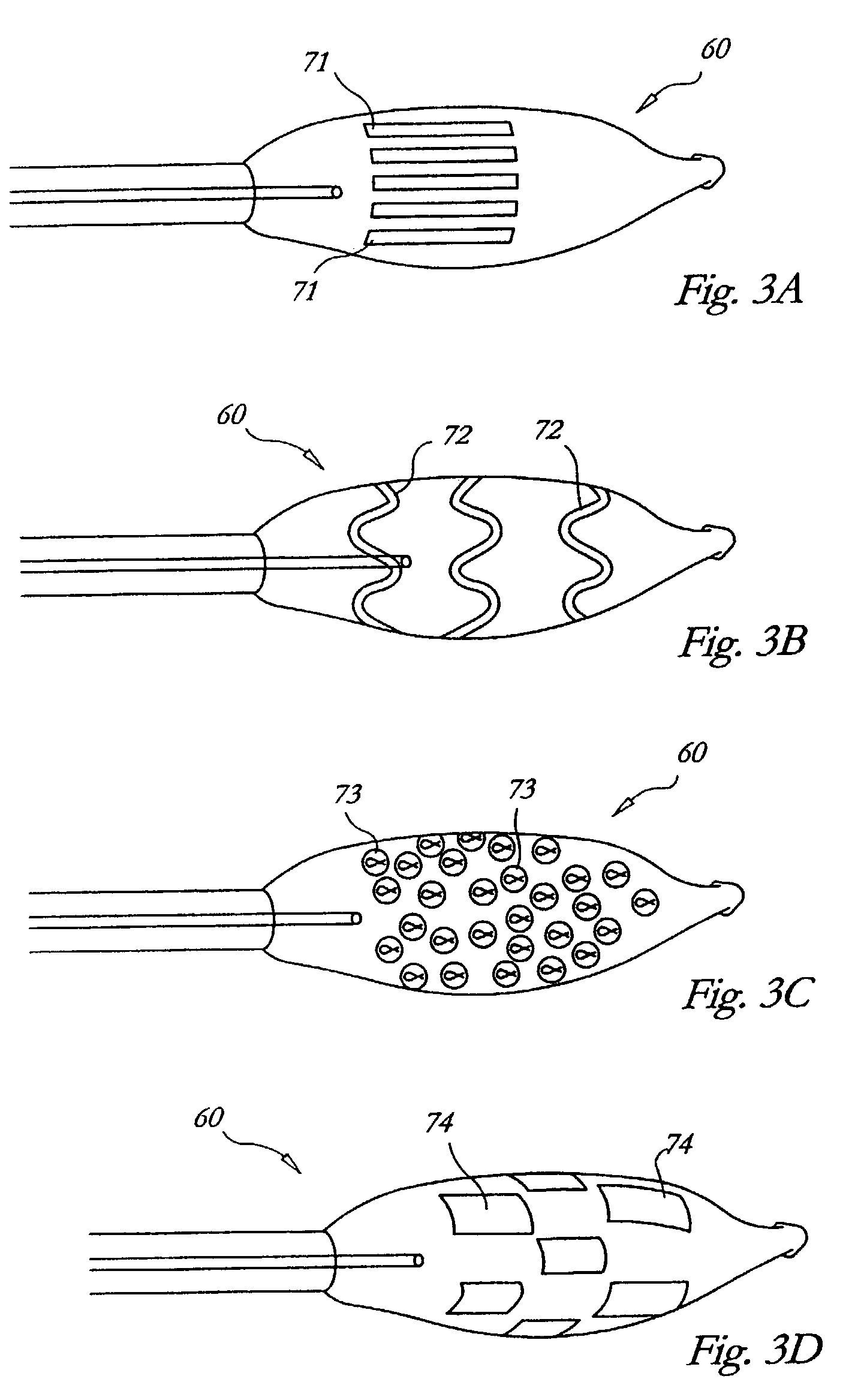 Endovascular cryotreatment catheter