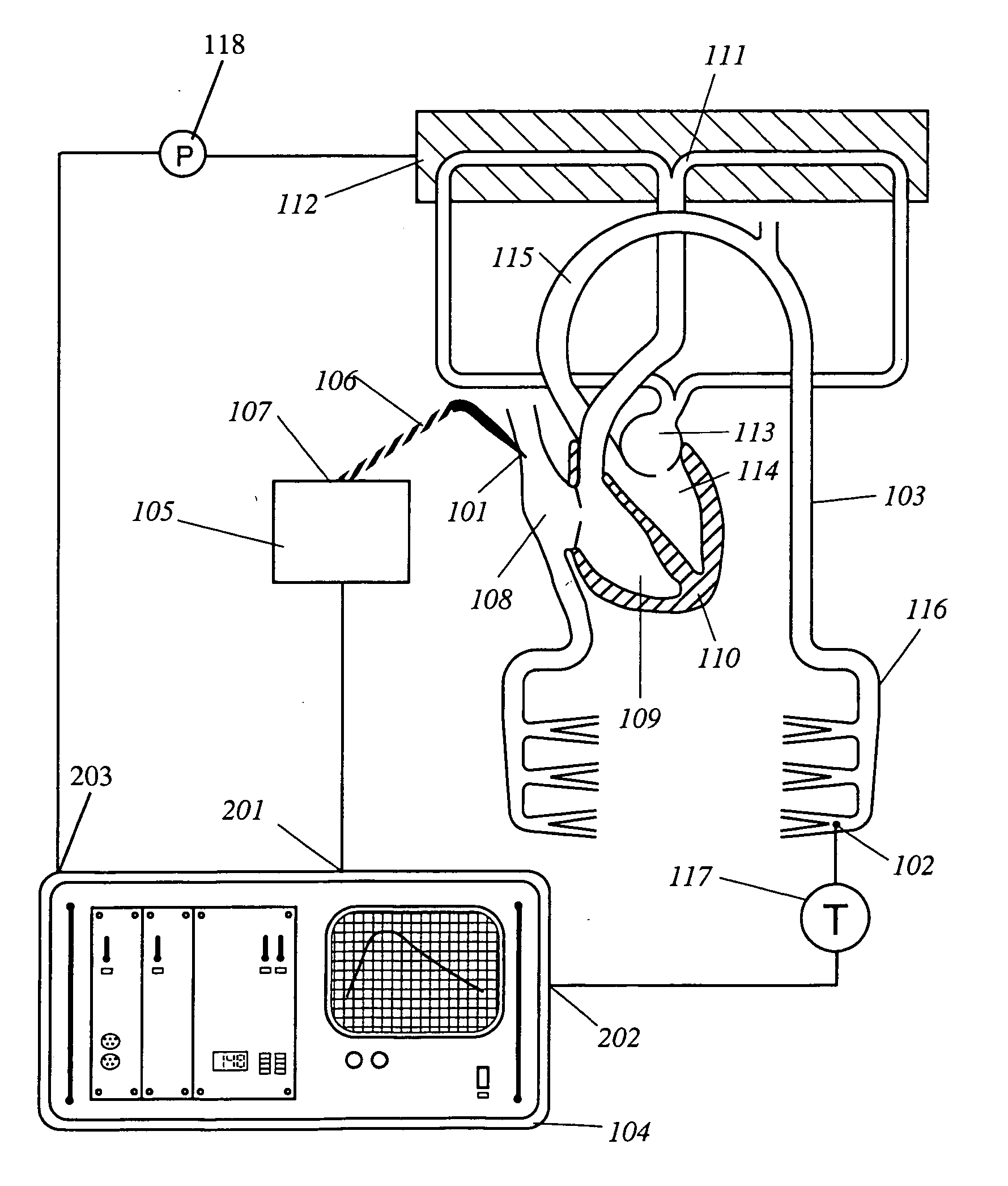 Apparatus, computer system and computer program for determining intrathoracic blood volume and other cardio-vascular parameters