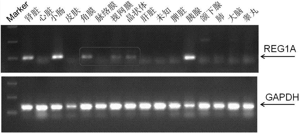 Application of REG1A protein in preparation of drugs for treating and/or preventing retinal cell apoptosis