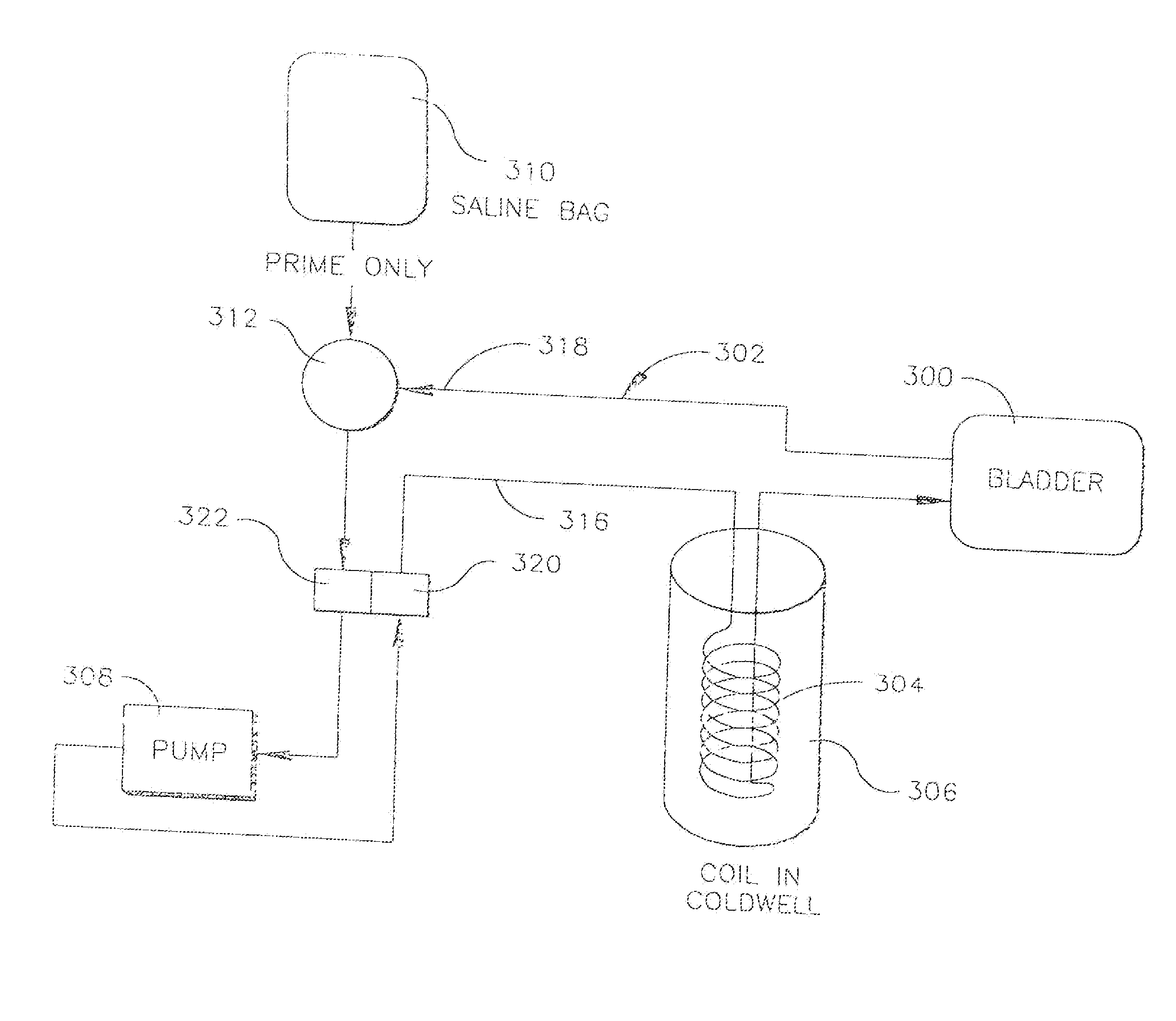 System and method for bringing hypothermia rapidly onboard