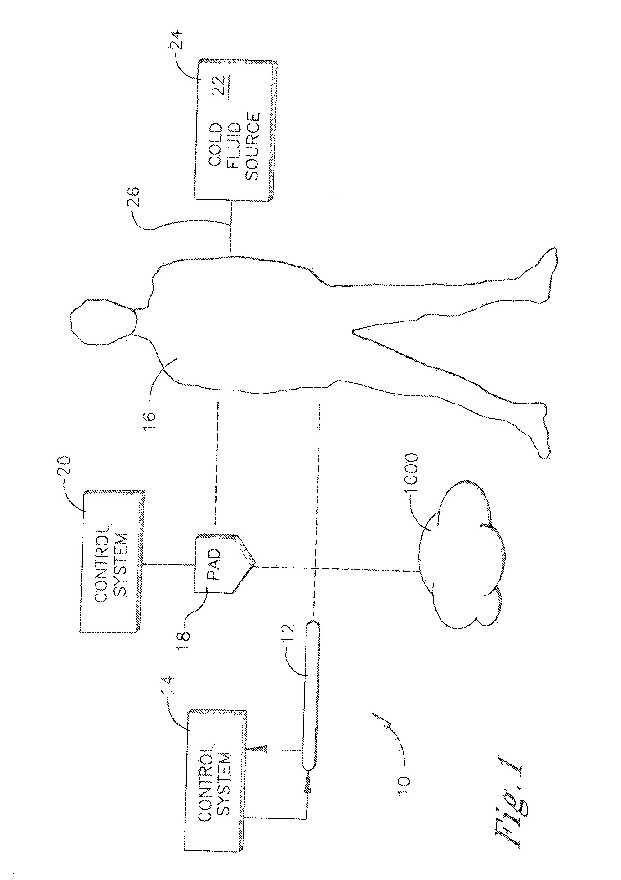 System and method for bringing hypothermia rapidly onboard