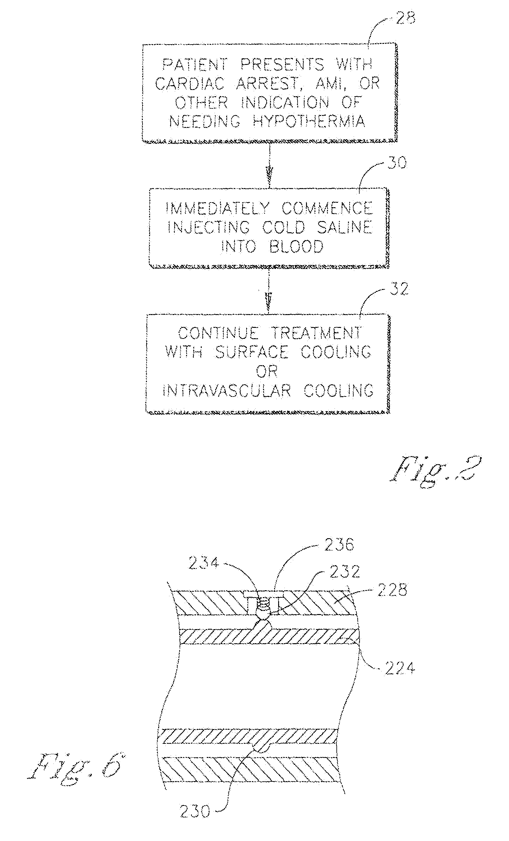 System and method for bringing hypothermia rapidly onboard