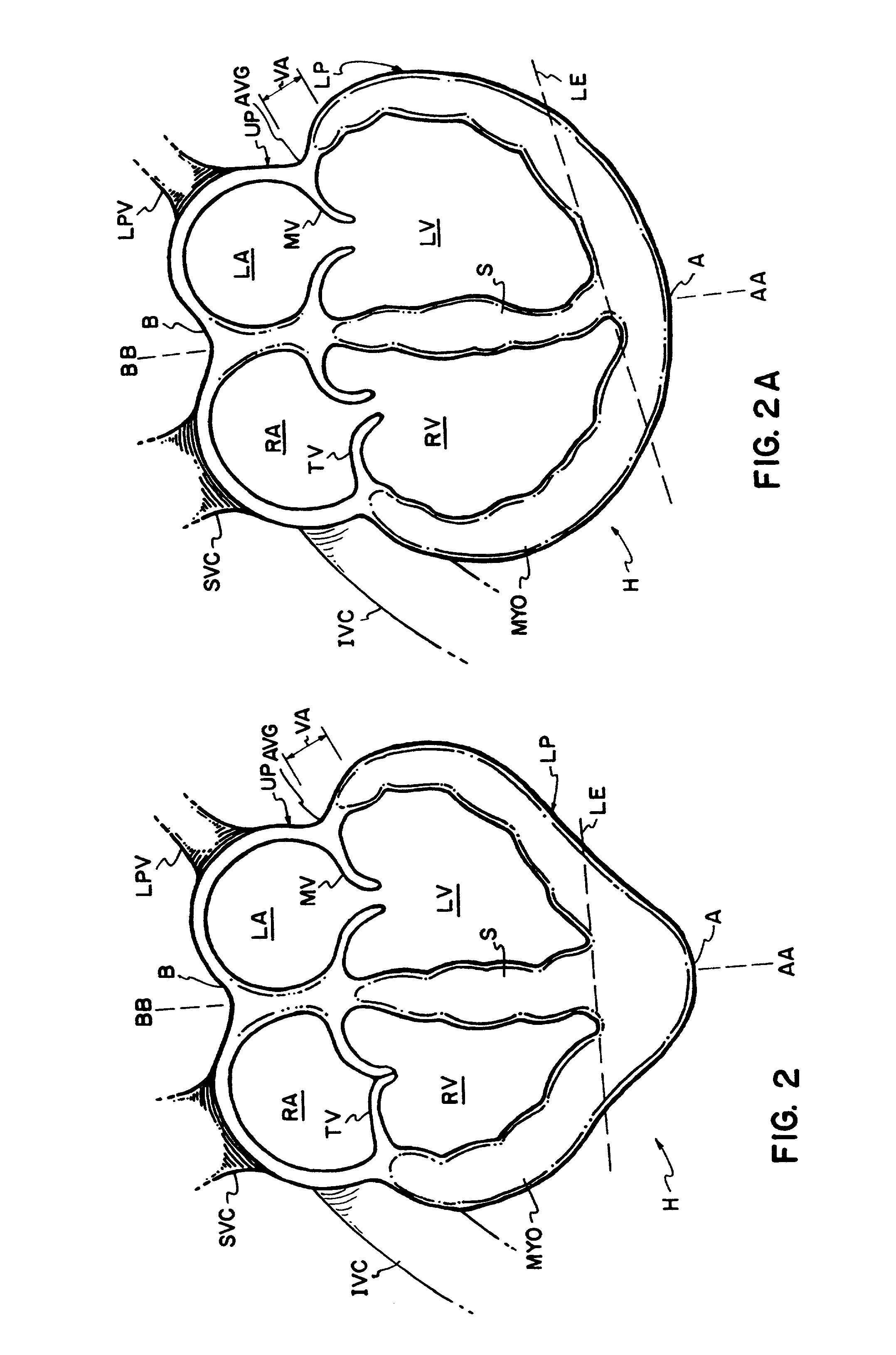 Device for heart measurement