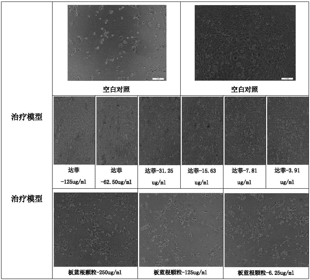 Application of chimonanthus plant in influenza virus resistance