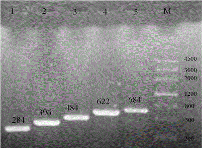 Kit and detecting method for quickly detecting mutiplex PCRs of five common pathogenic bacteria in disposable hygiene products