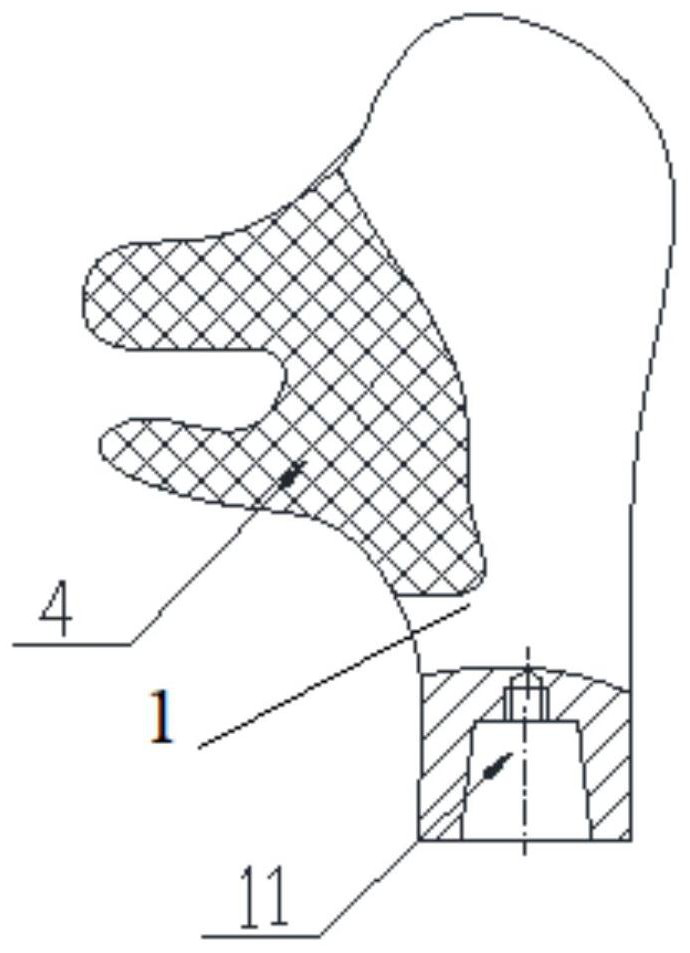 Pelvic prosthesis