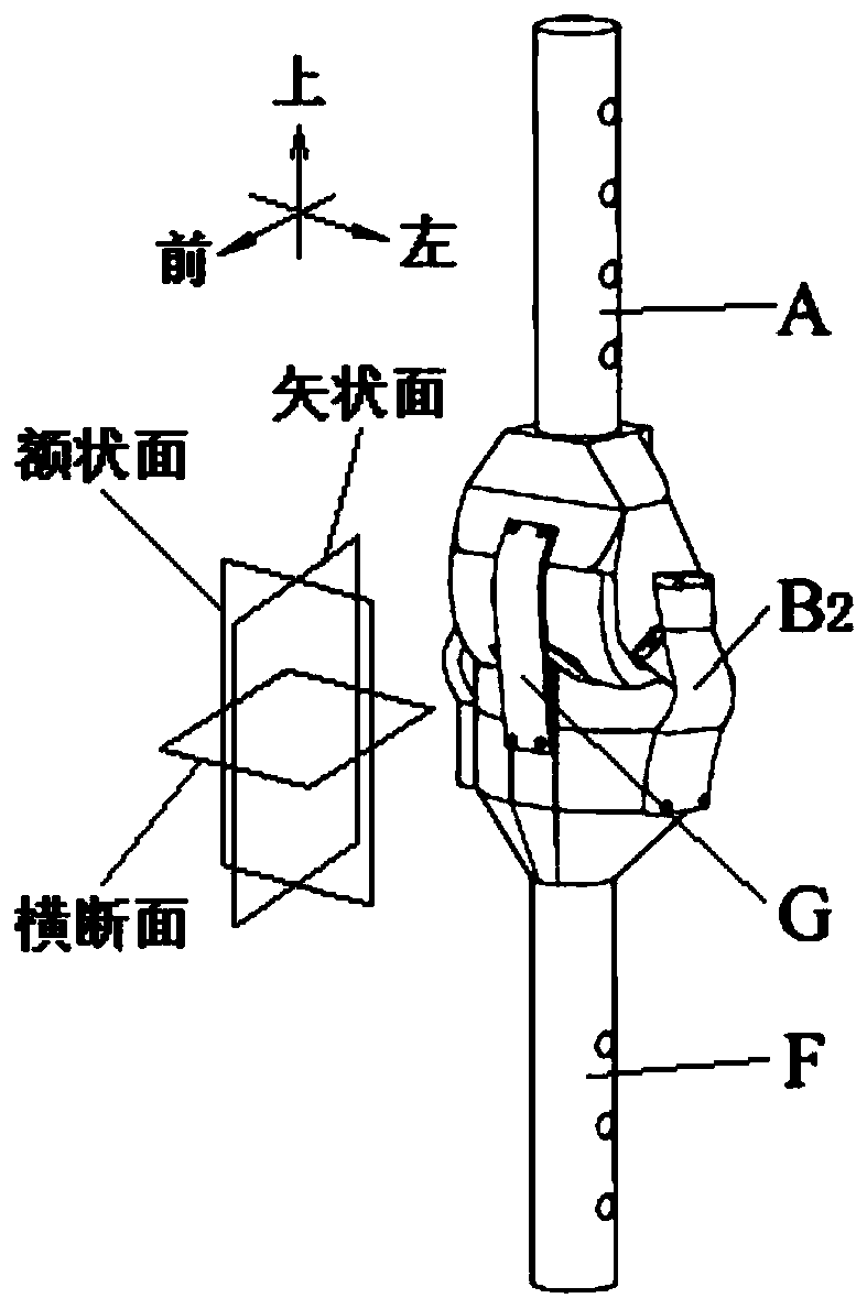 A flexible impact-resistant bionic tension-compression body knee joint