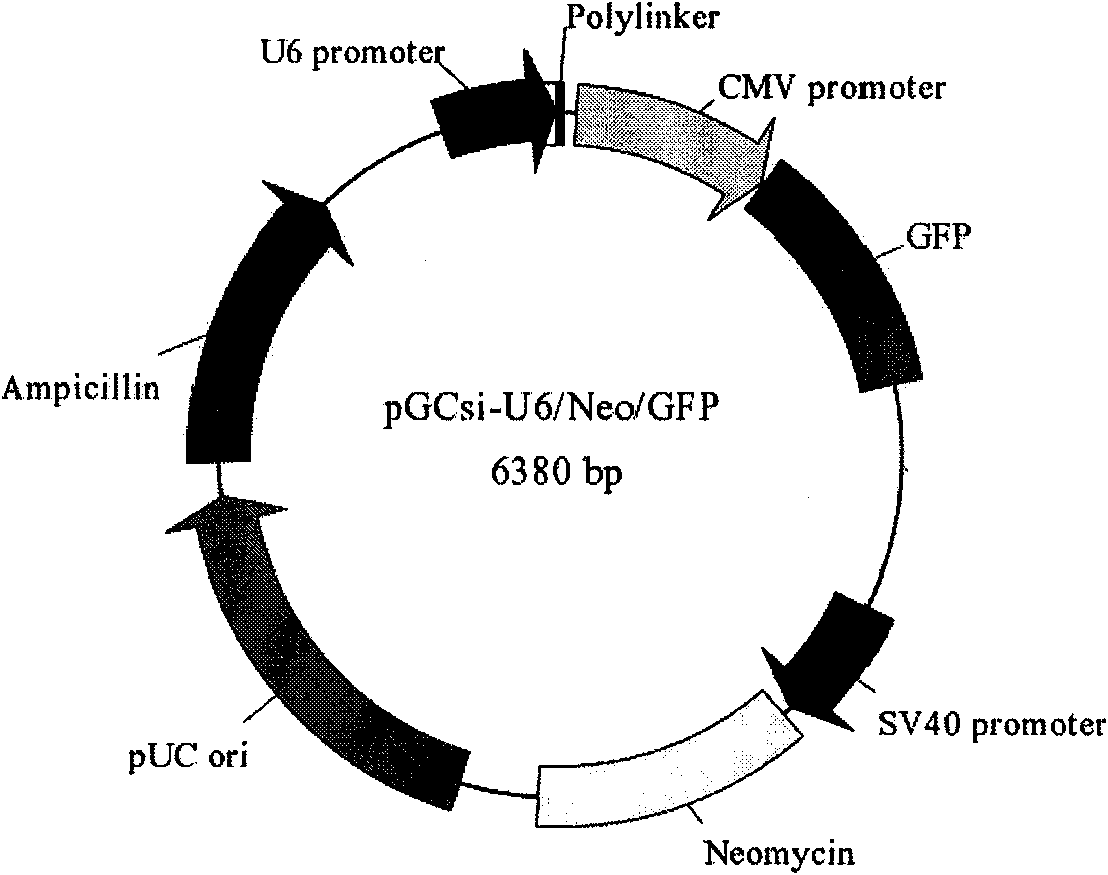 Thymosin beta4 gene expression inhibiting RNA and use thereof