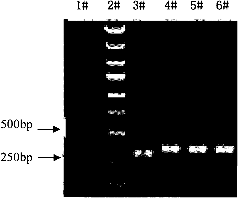 Thymosin beta4 gene expression inhibiting RNA and use thereof