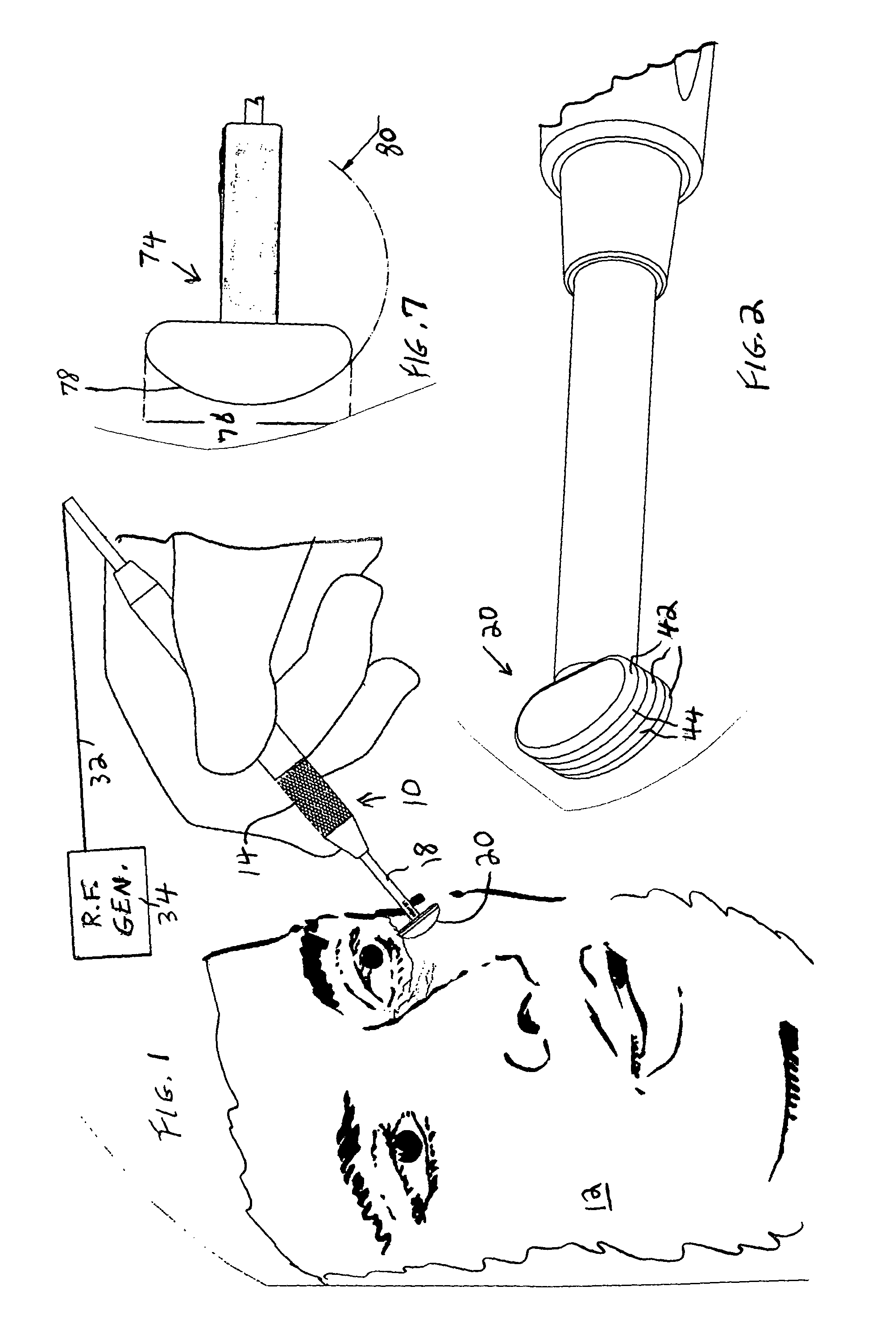 Non-ablative radio-frequency treatment of skin tissue