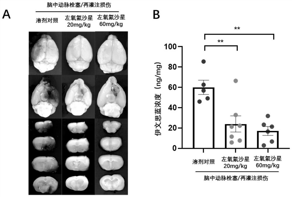 Application of levofloxacin or pharmaceutically acceptable salt thereof in preparation of anti-cerebral ischemia-reperfusion injury medicine or health product