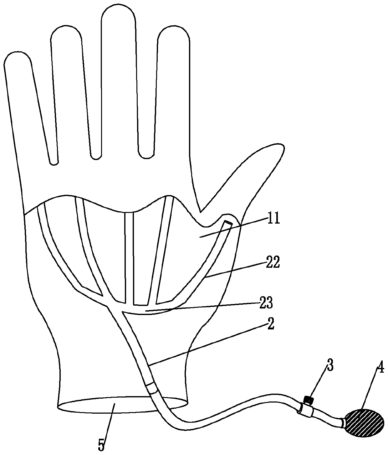 Hand detumescence pressure sleeve