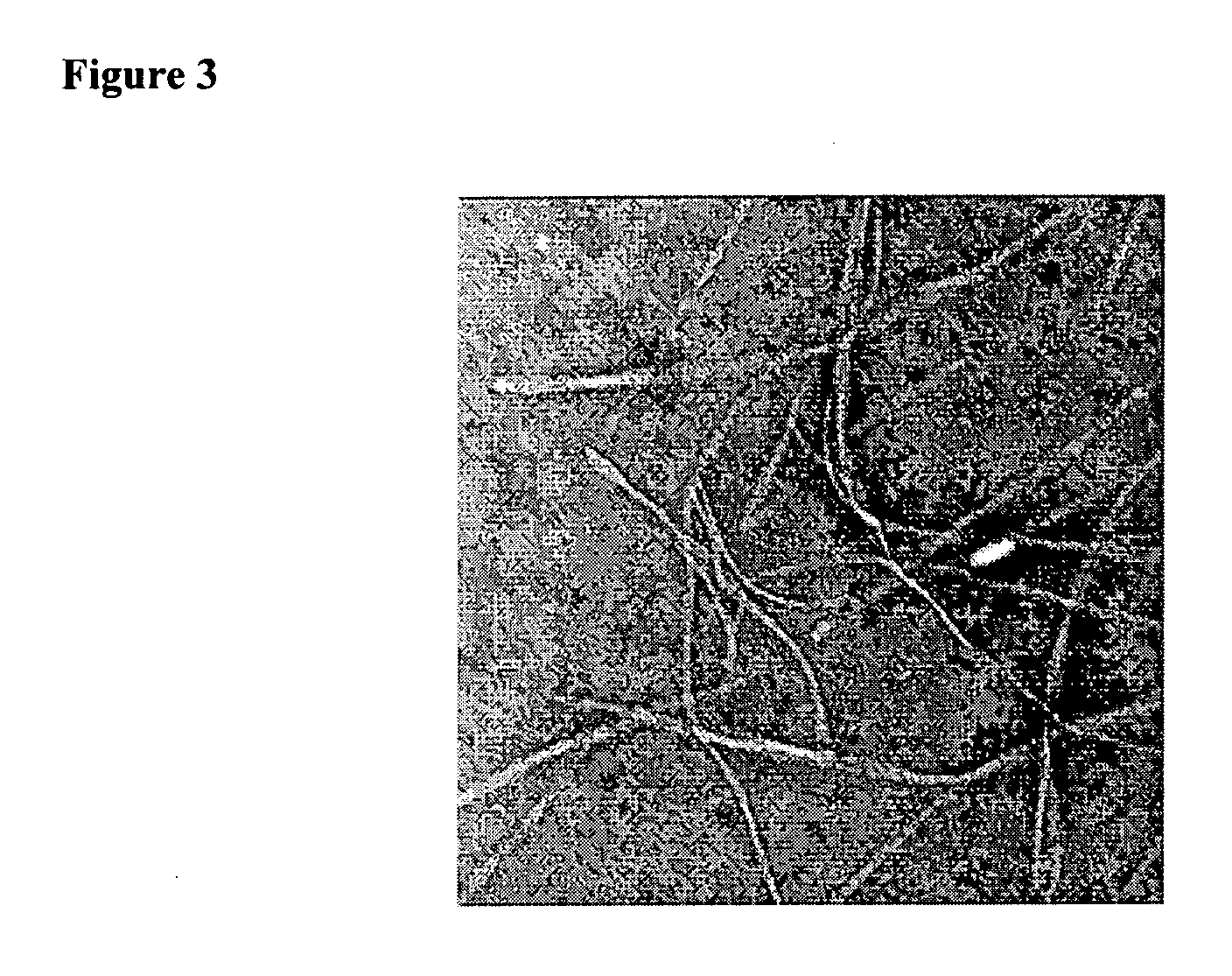 Amphiphilic peptides and hydrogel matrices thereof for bone repair