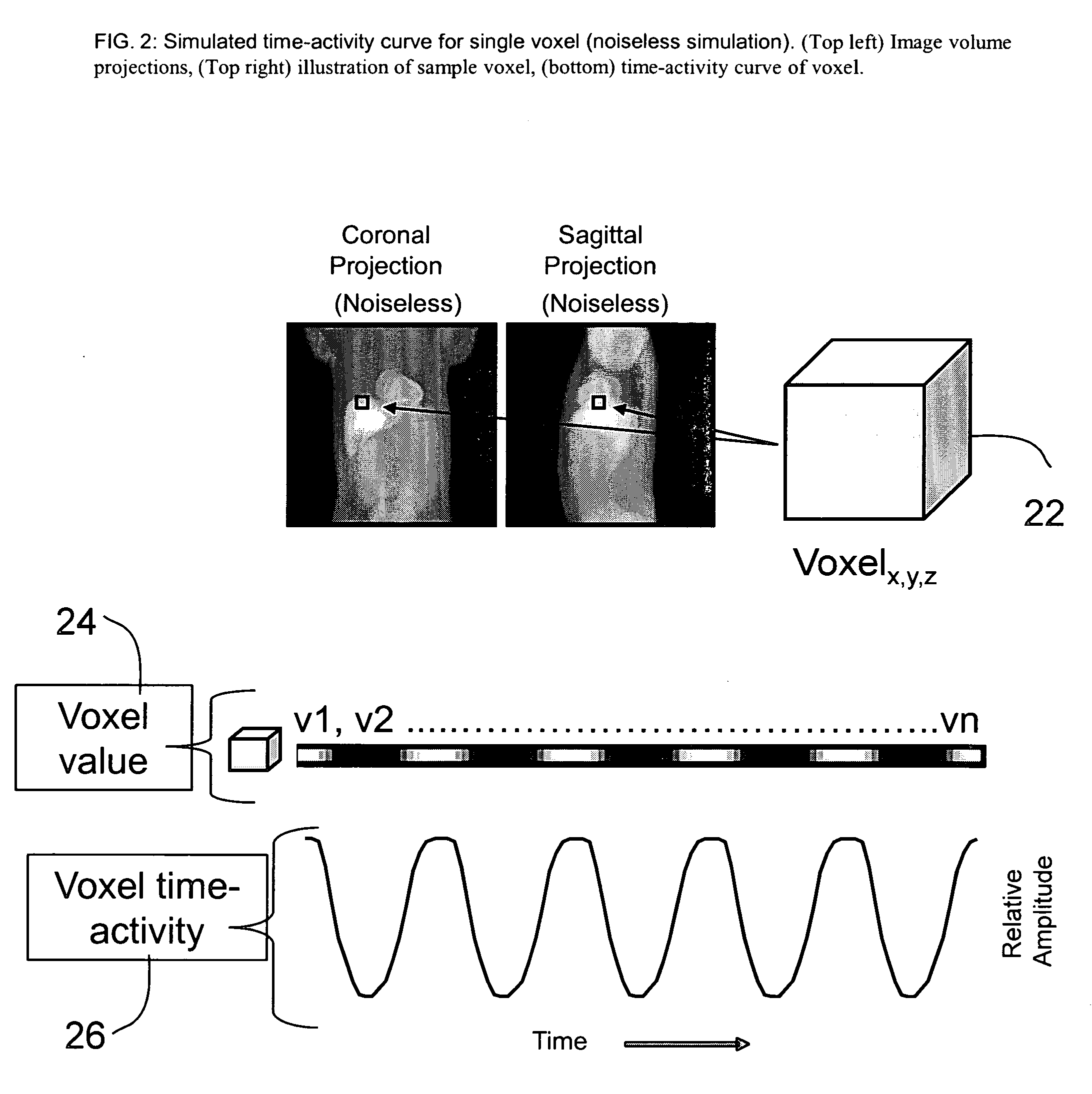 Methods and systems for retrospective internal gating