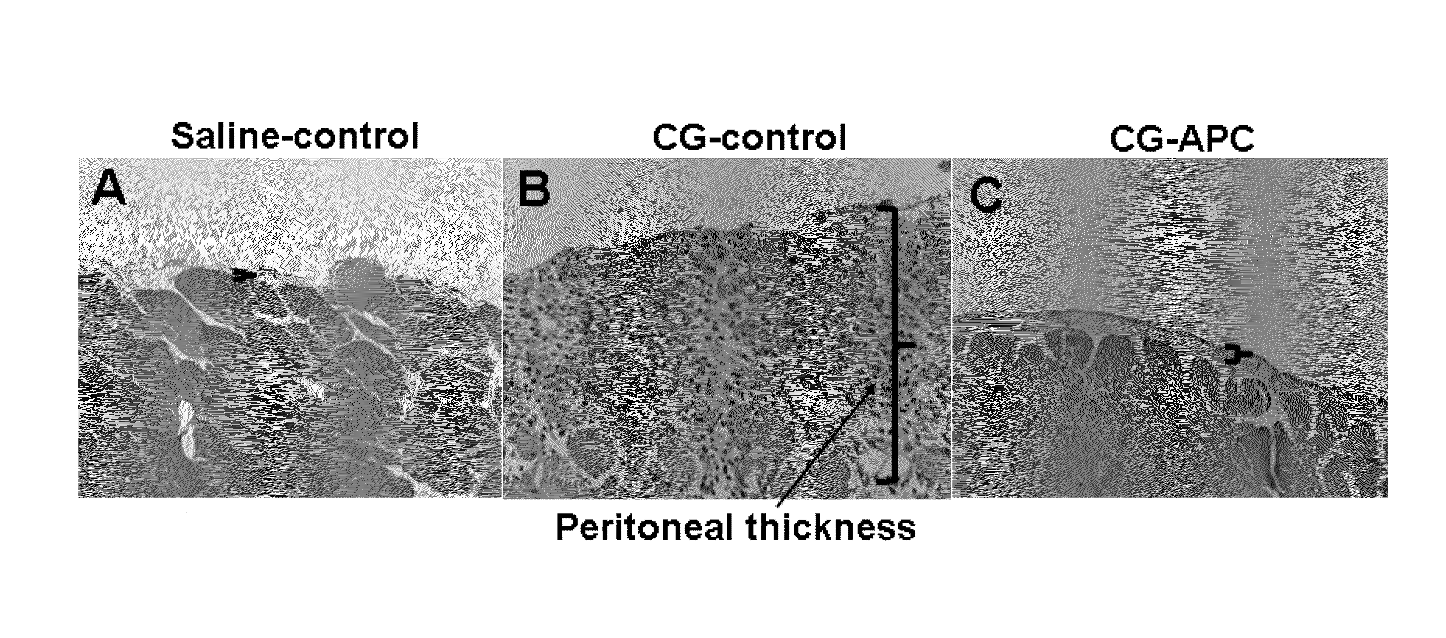 Methods for reducing fibrosis induced by peritoneal dialysis