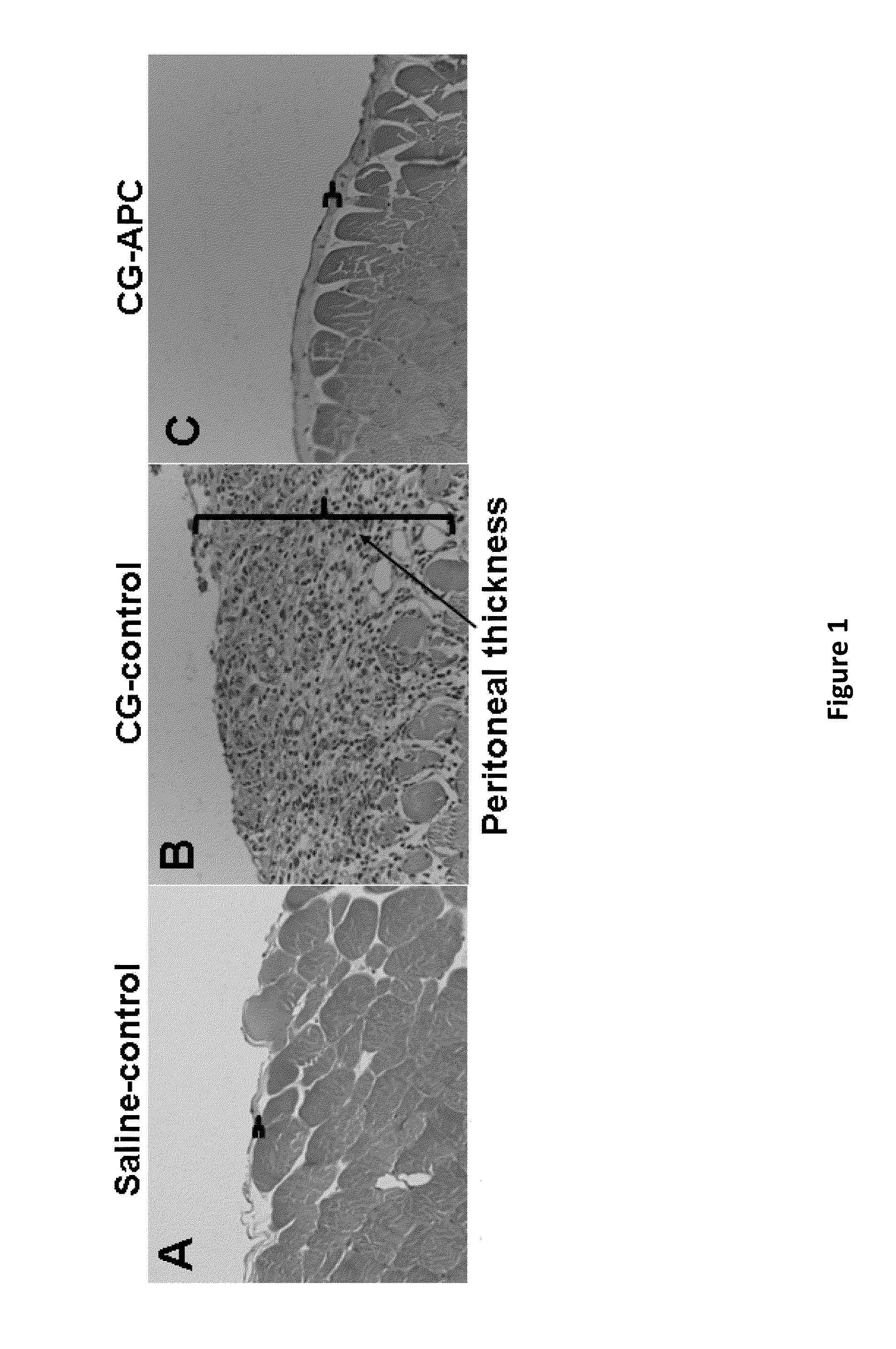 Methods for reducing fibrosis induced by peritoneal dialysis