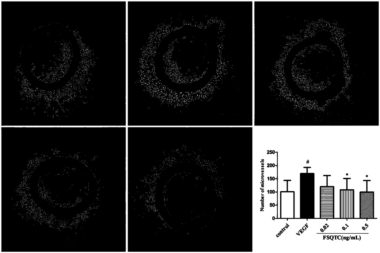 Application of rheumatic pain-relieving traditional Chinese medicinal composition to preparation of anti-angiogenesis medicament