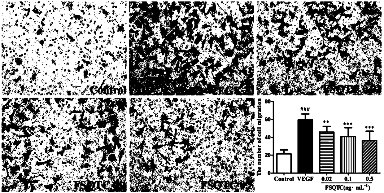 Application of rheumatic pain-relieving traditional Chinese medicinal composition to preparation of anti-angiogenesis medicament