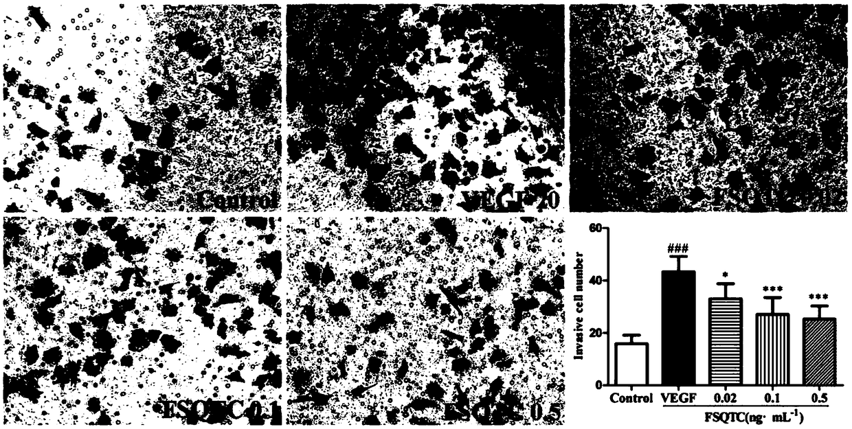 Application of rheumatic pain-relieving traditional Chinese medicinal composition to preparation of anti-angiogenesis medicament