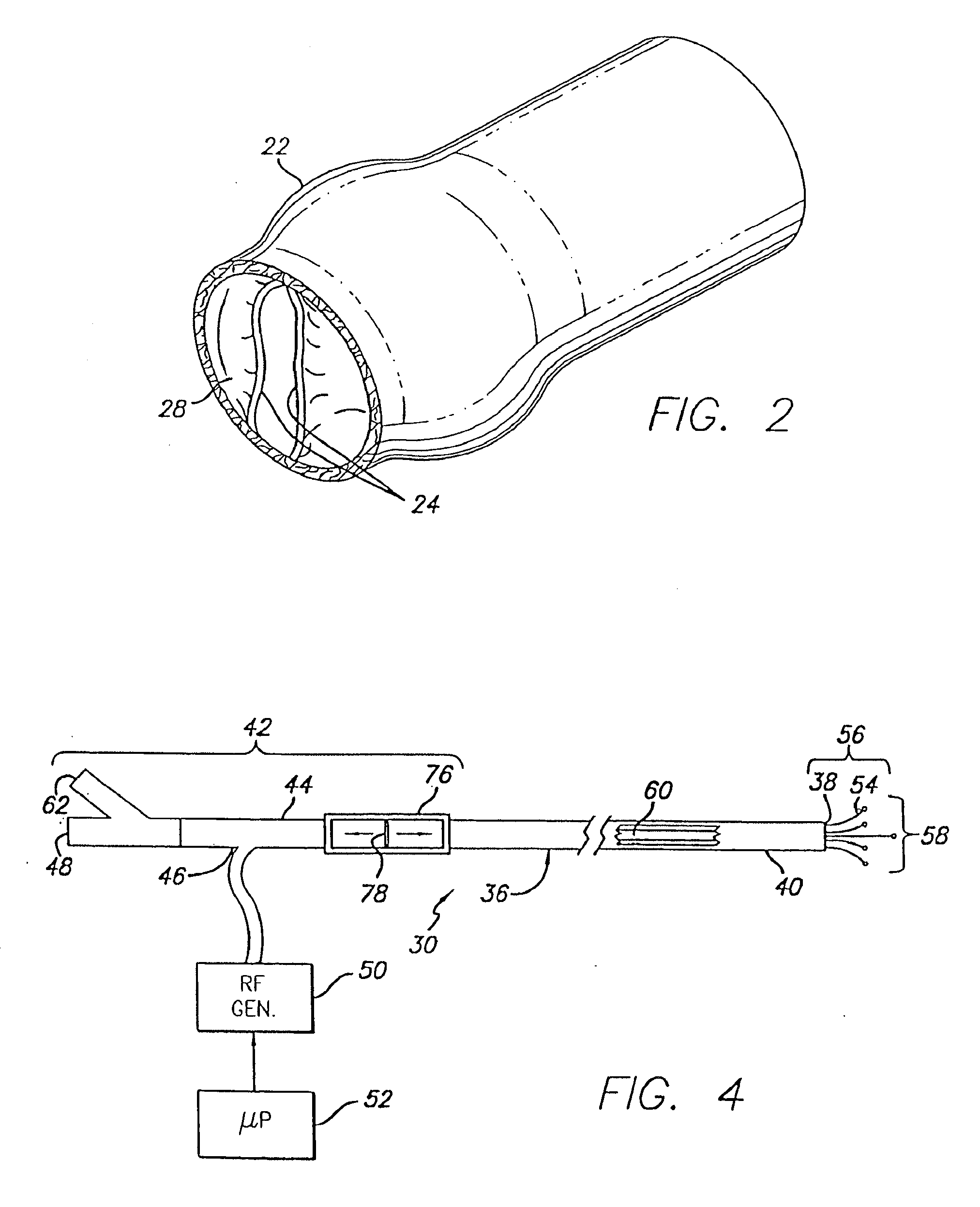 Method and apparatus for applying energy to biological tissue including the use of tumescent tissue compression