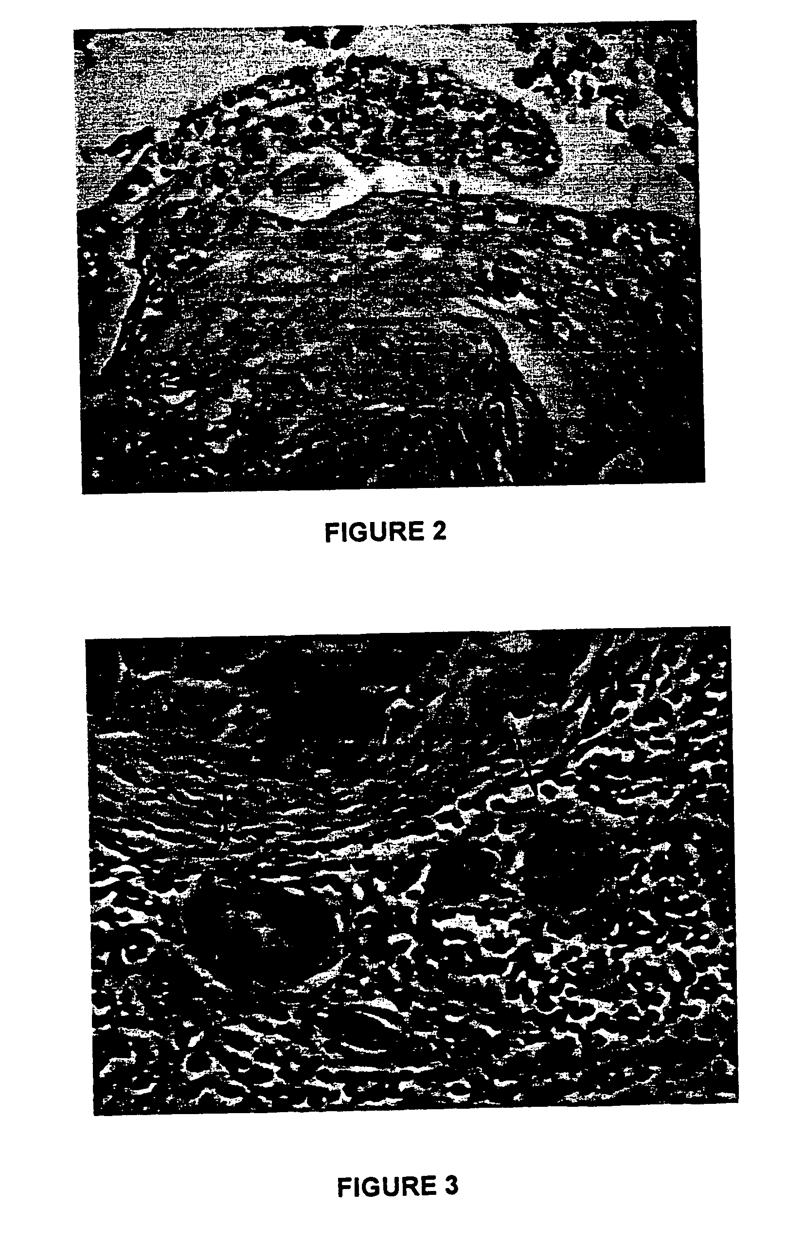 Biodegradable, non-toxic biological adhesive for use in abdominal surgery