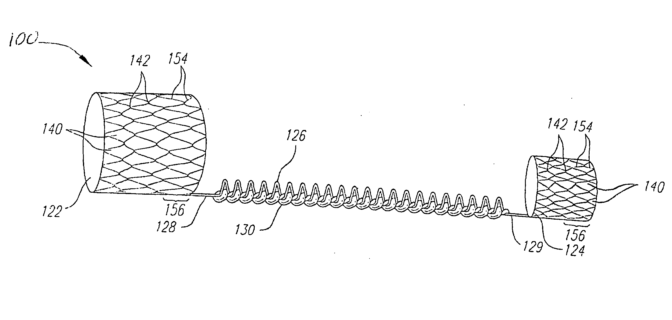 Anchoring system for medical implant