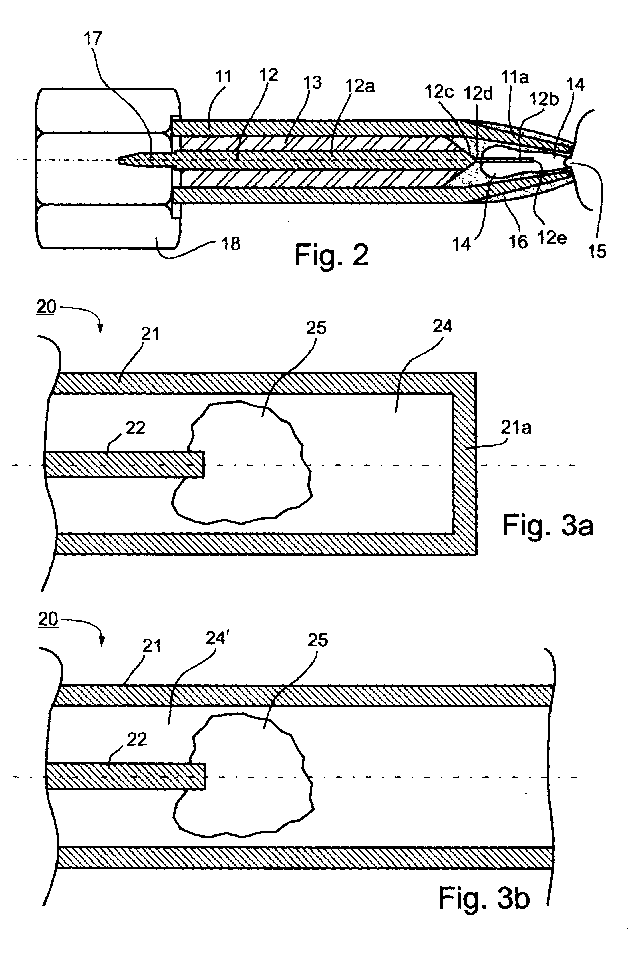 Method and system for examining tissue according to the dielectric properties thereof