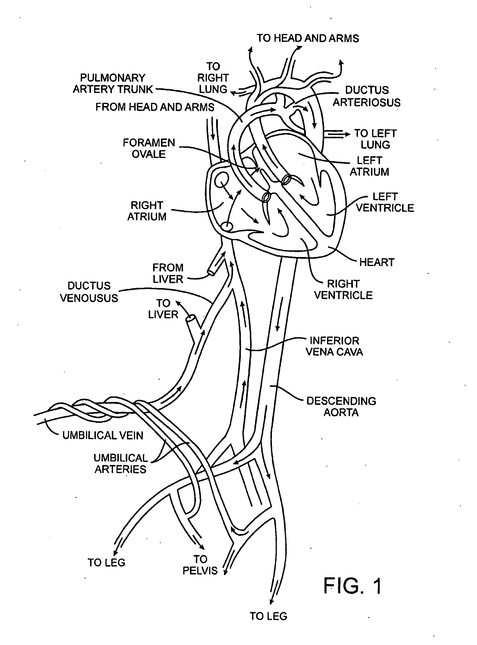 Energy based devices and methods for treatment of patent foramen ovale