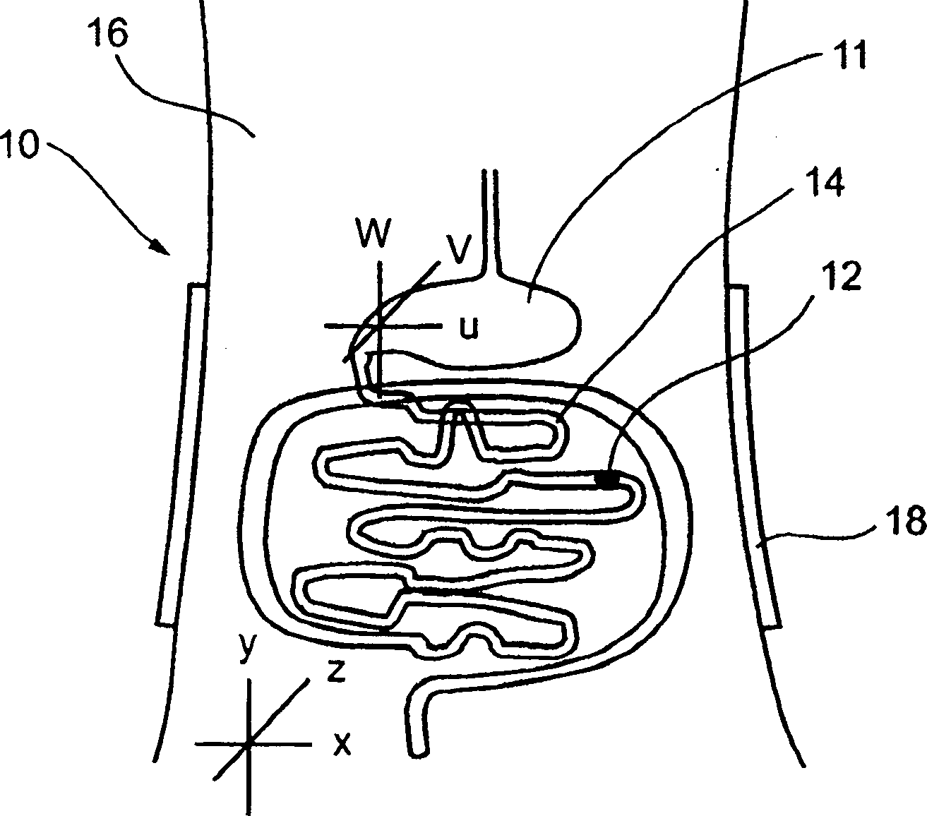 Ingestible pill