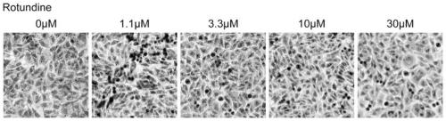 Application of rotundine in preparation of medicine for treating fatty liver