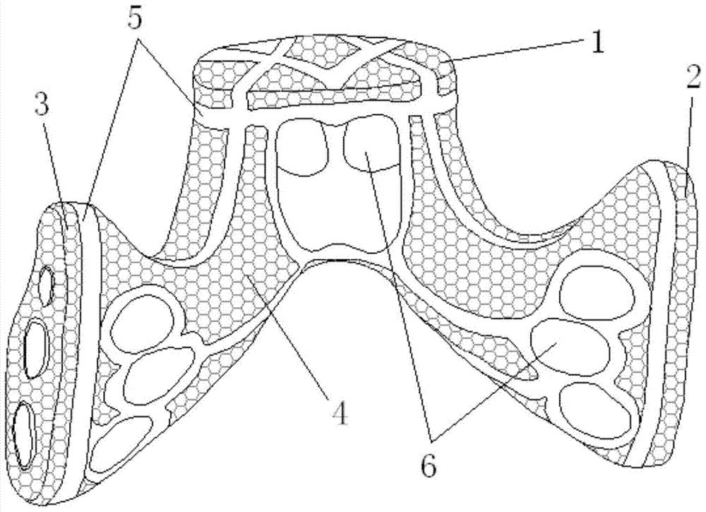 A total sacral artificial prosthesis