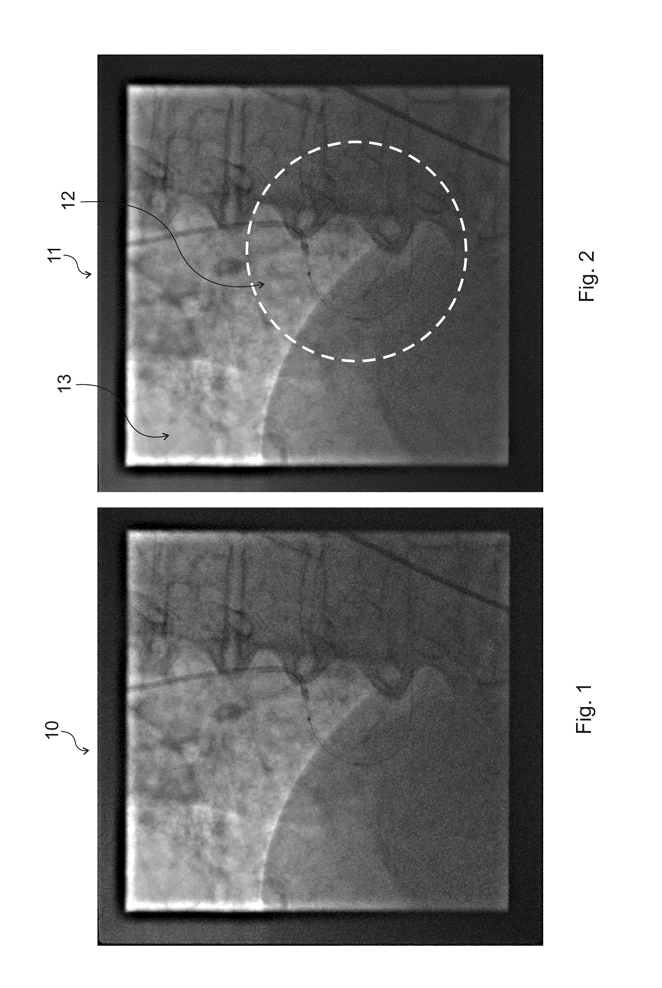 Method, system and computer readable medium for processing a medical video image