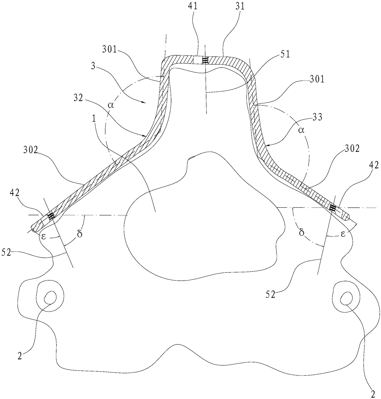 A screw plate system for posterior fixation of the axis