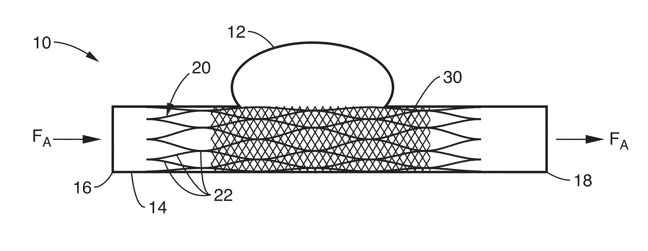 Ultra-low fractional area coverage flow diverter for treating aneurysms and vascular diseases