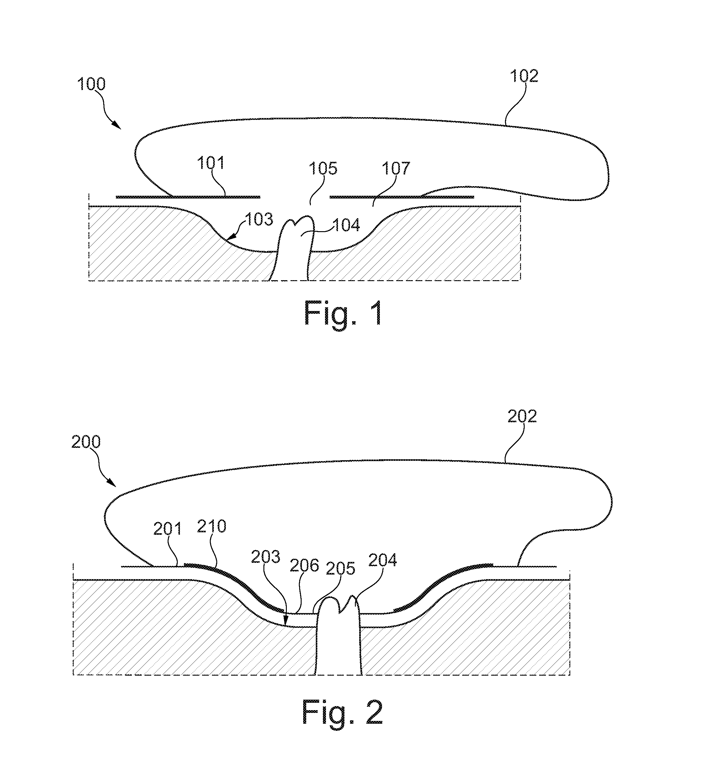 Ostomy appliance