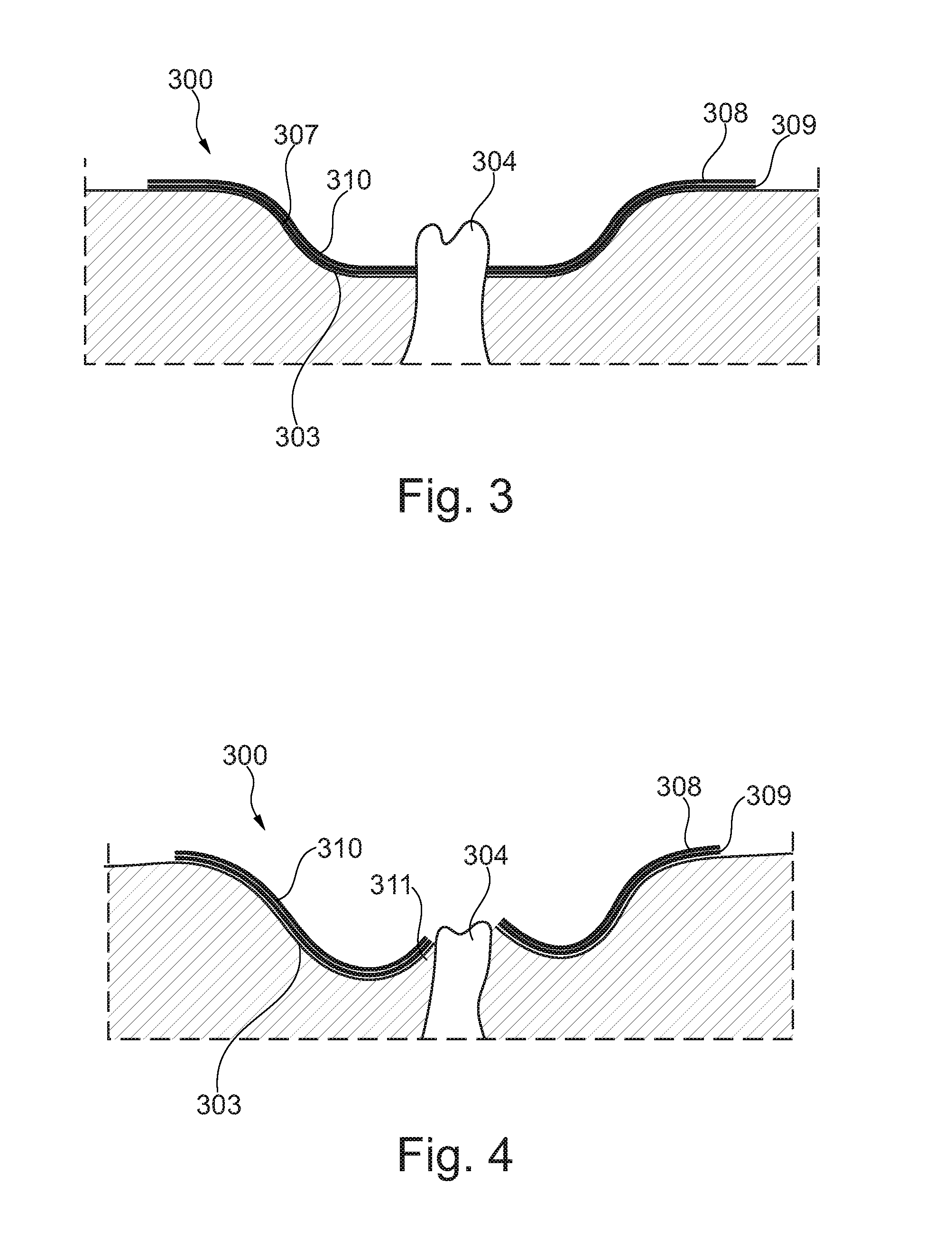 Ostomy appliance