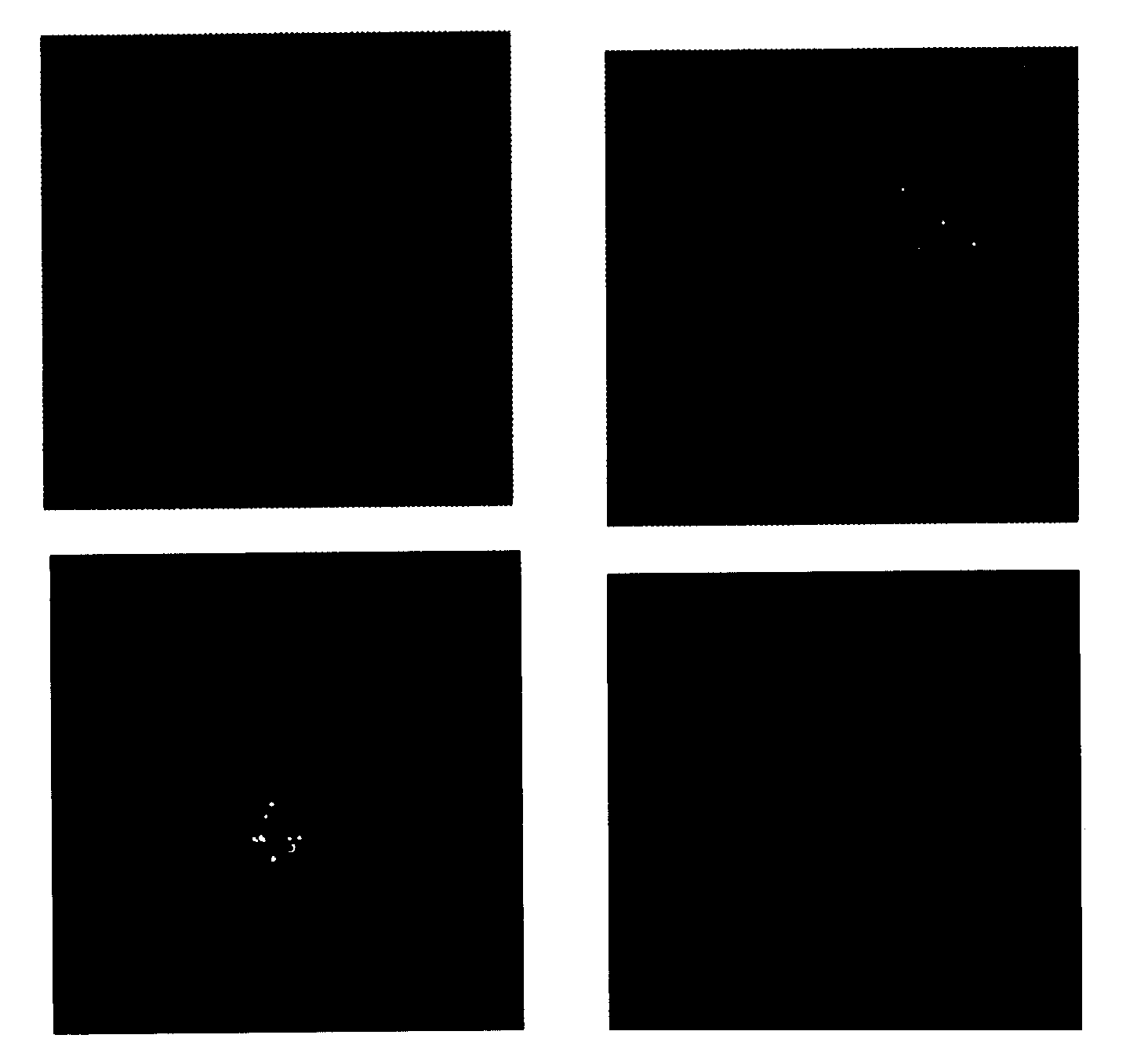 Infectious clone of human parvovirus B19 and methods