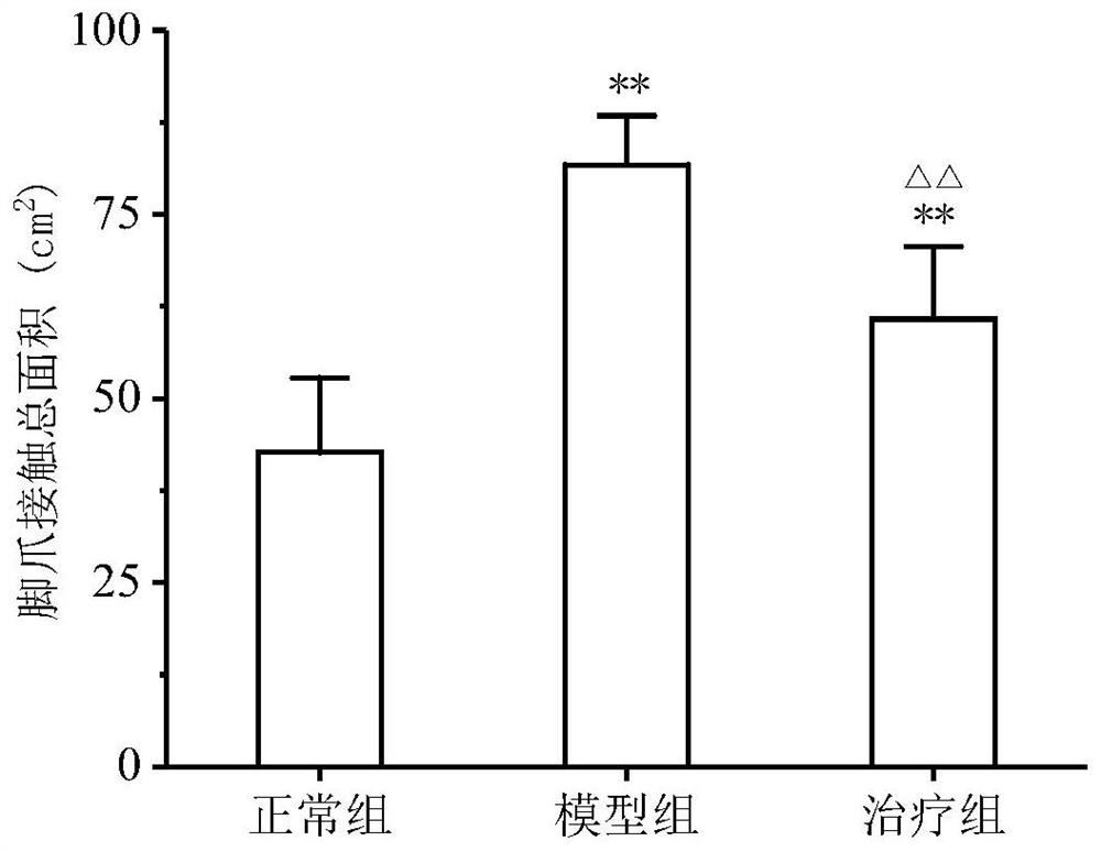 Application of traditional Chinese medicine composition in preparation of medicine for preventing or treating nervous system diseases