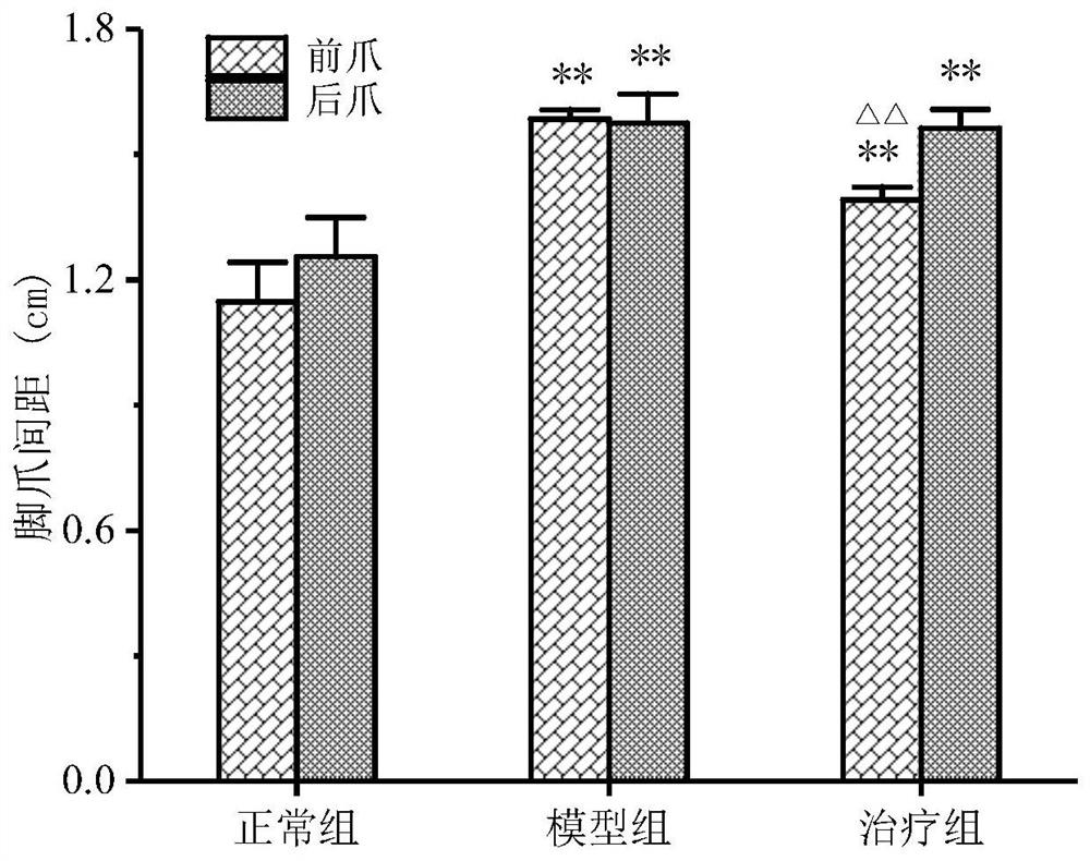 Application of traditional Chinese medicine composition in preparation of medicine for preventing or treating nervous system diseases